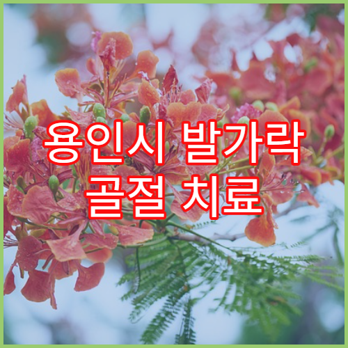 용인시 발가락 골절 치료 가능한 정형외과