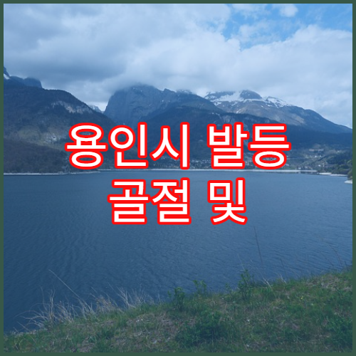용인시 발등 골절 및 부종 치료 병원