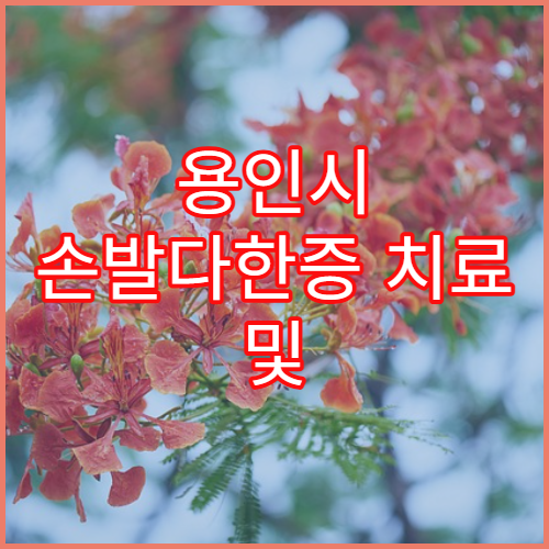 용인시 손발다한증 치료 및 수술 병원