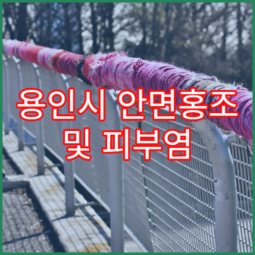 용인시 안면홍조 및 피부염 치료 병원