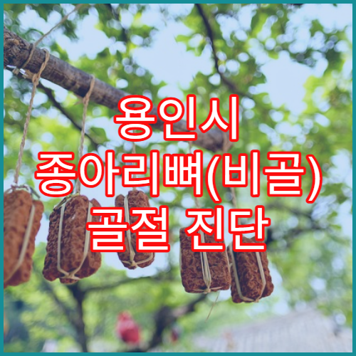 용인시 종아리뼈(비골) 골절 진단 및 회복 병원