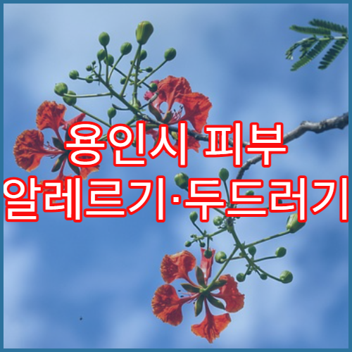 용인시 피부 알레르기·두드러기 치료 병원
